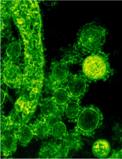 Black-BGND-Green-Microbes